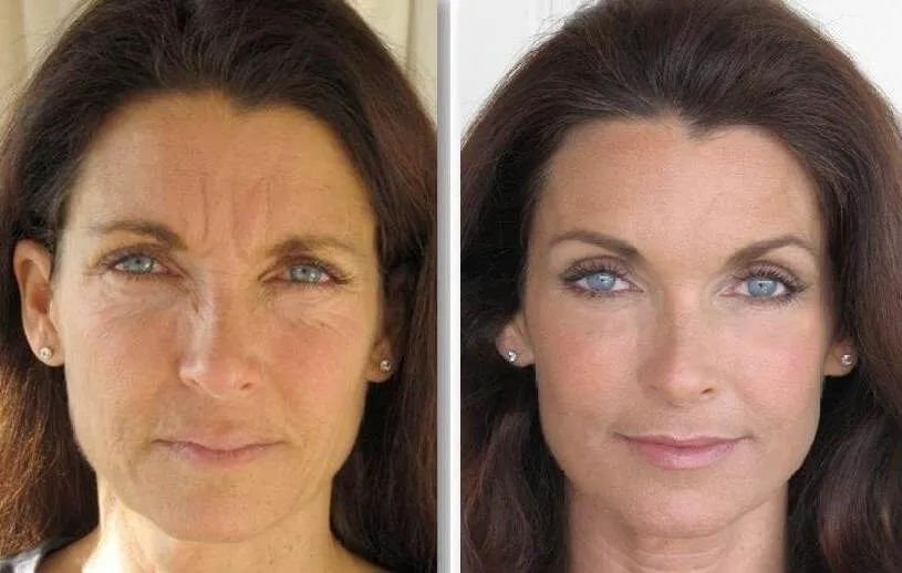 Wrinkless : sastav samo prirodnih sastojaka.